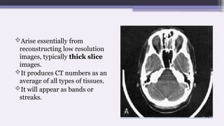 Arise essentially from
reconstructing low resolution
images, typically thick slice
images.
It produces CT numbers as an
average of all types of tissues.
It will appear as bands or
streaks.
 