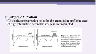 2. Adaptive Filtration
This software correction smooths the attenuation profile in areas
of high attenuation before the image is reconstructed.
 