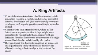 A. Ring Artifacts
If one of the detectors is out of calibration on a third-
generation (rotating x-ray tube and detector assembly)
scanner, the detector will give a consistently erroneous
reading at each angular position, resulting in a circular
artifact.
A scanner with solid-state detectors, where all the
detectors are separate entities, is in principle more
susceptible to ring artifacts than a scanner with gas
detectors, in which the detector array consists of a single
xenon-filled chamber subdivided by electrodes.
They can impair the diagnostic quality of an image, and
this is particularly likely when central detectors are
affected, creating a dark smudge at the center of the
image.
 