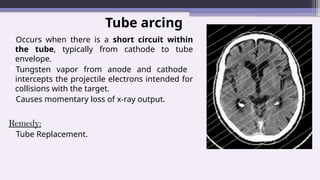 Tube arcing
Occurs when there is a short circuit within
the tube, typically from cathode to tube
envelope.
Tungsten vapor from anode and cathode
intercepts the projectile electrons intended for
collisions with the target.
Causes momentary loss of x-ray output.
Remedy:
Tube Replacement.
 