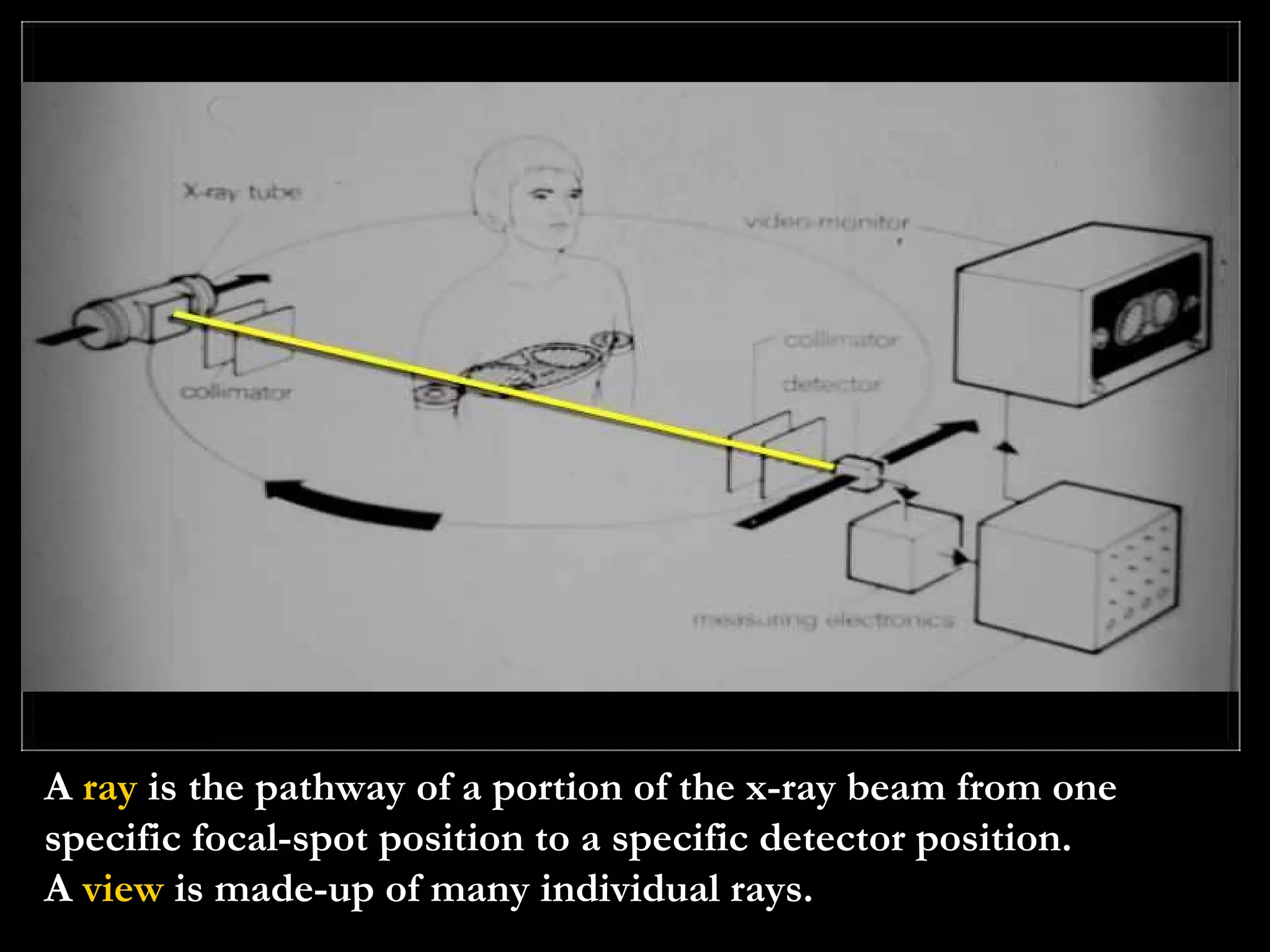 A  ray  is the pathway of a portion of the x-ray beam from one specific focal-spot position to a specific detector position. A  view  is made-up of many individual rays. 