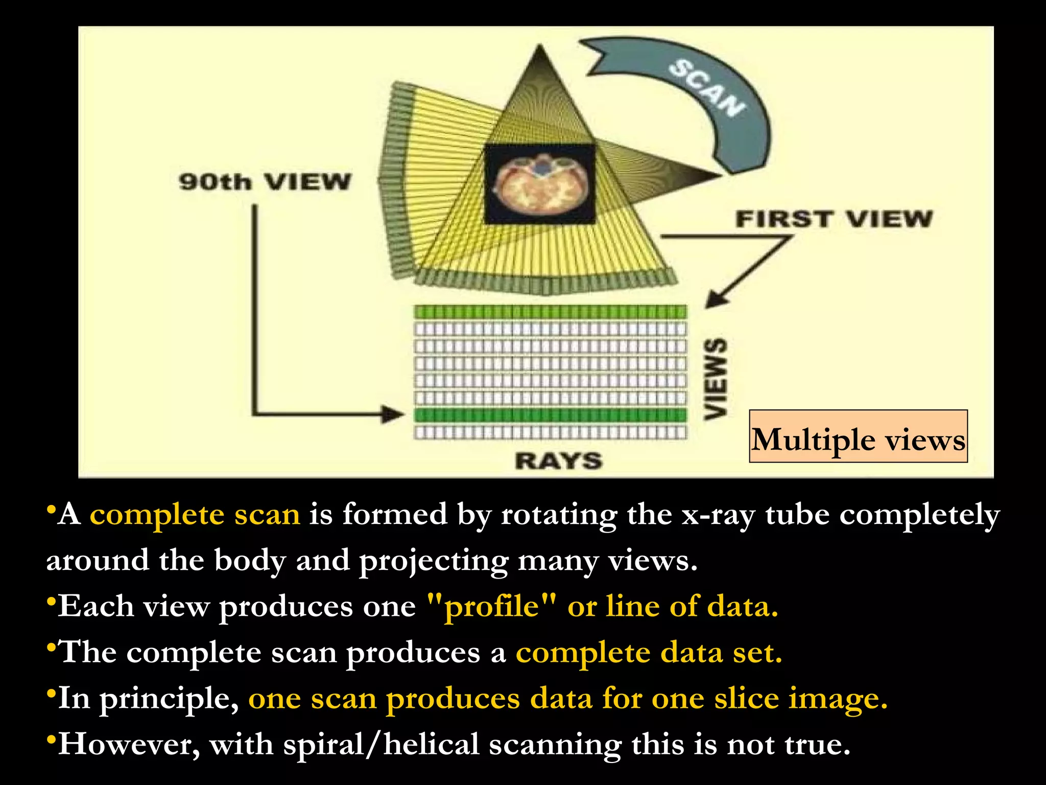 A  complete scan  is formed by rotating the x-ray tube completely around the body and projecting many views.  Each view produces one  "profile" or line of data. The complete scan produces a  complete data set.   In principle,  one scan produces data for one slice image.   However, with spiral/helical scanning this is not true. Multiple views 