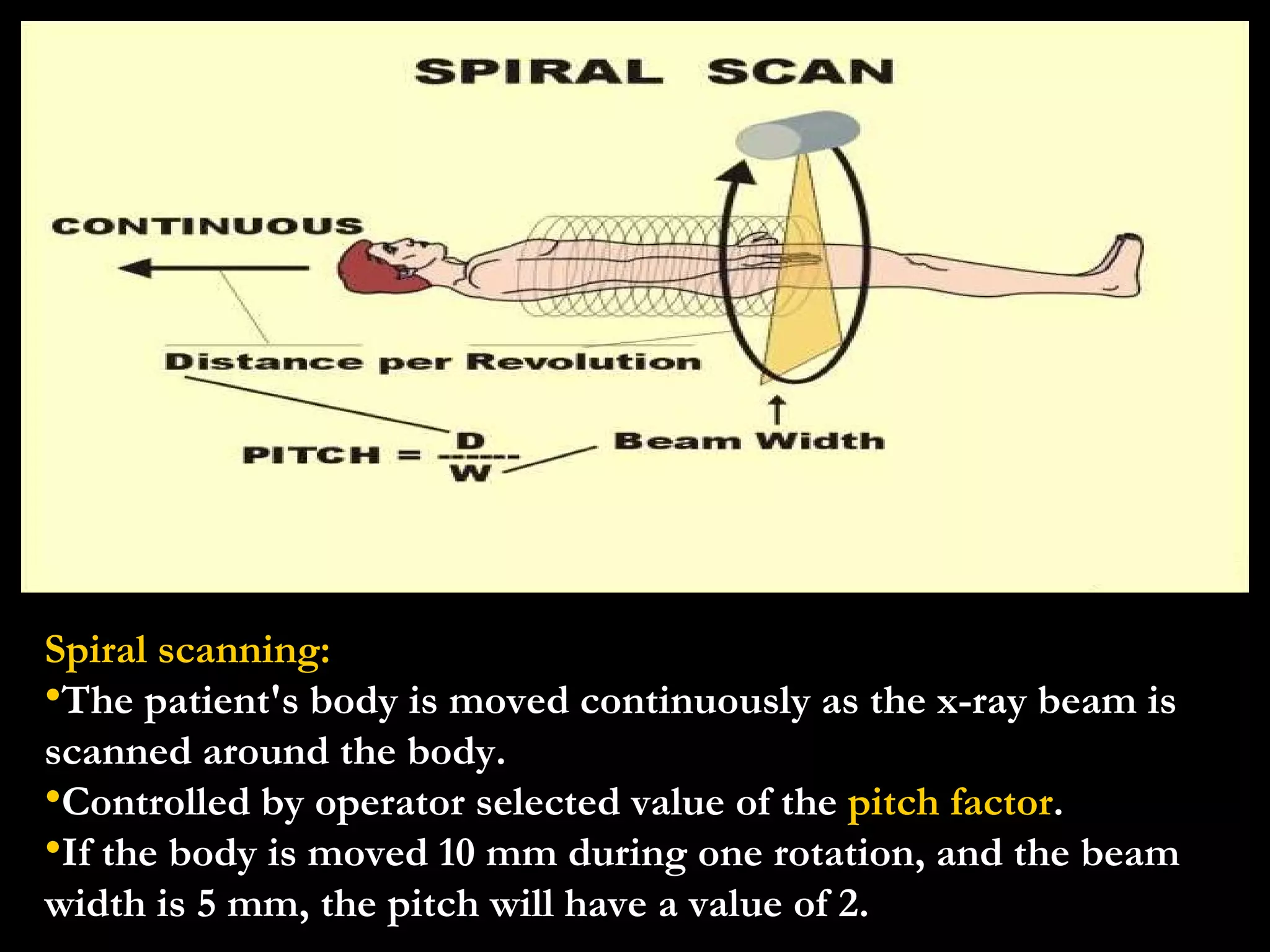 Spiral scanning: The patient's body is moved continuously as the x-ray beam is scanned around the body. Controlled by operator selected value of the  pitch factor . If the body is moved 10 mm during one rotation, and the beam width is 5 mm, the pitch will have a value of 2. 