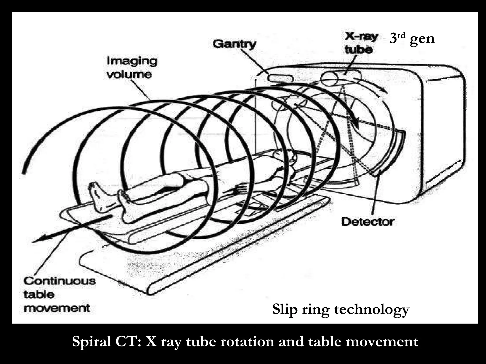 Spiral CT: X ray tube rotation and table movement 3 rd  gen Slip ring technology 