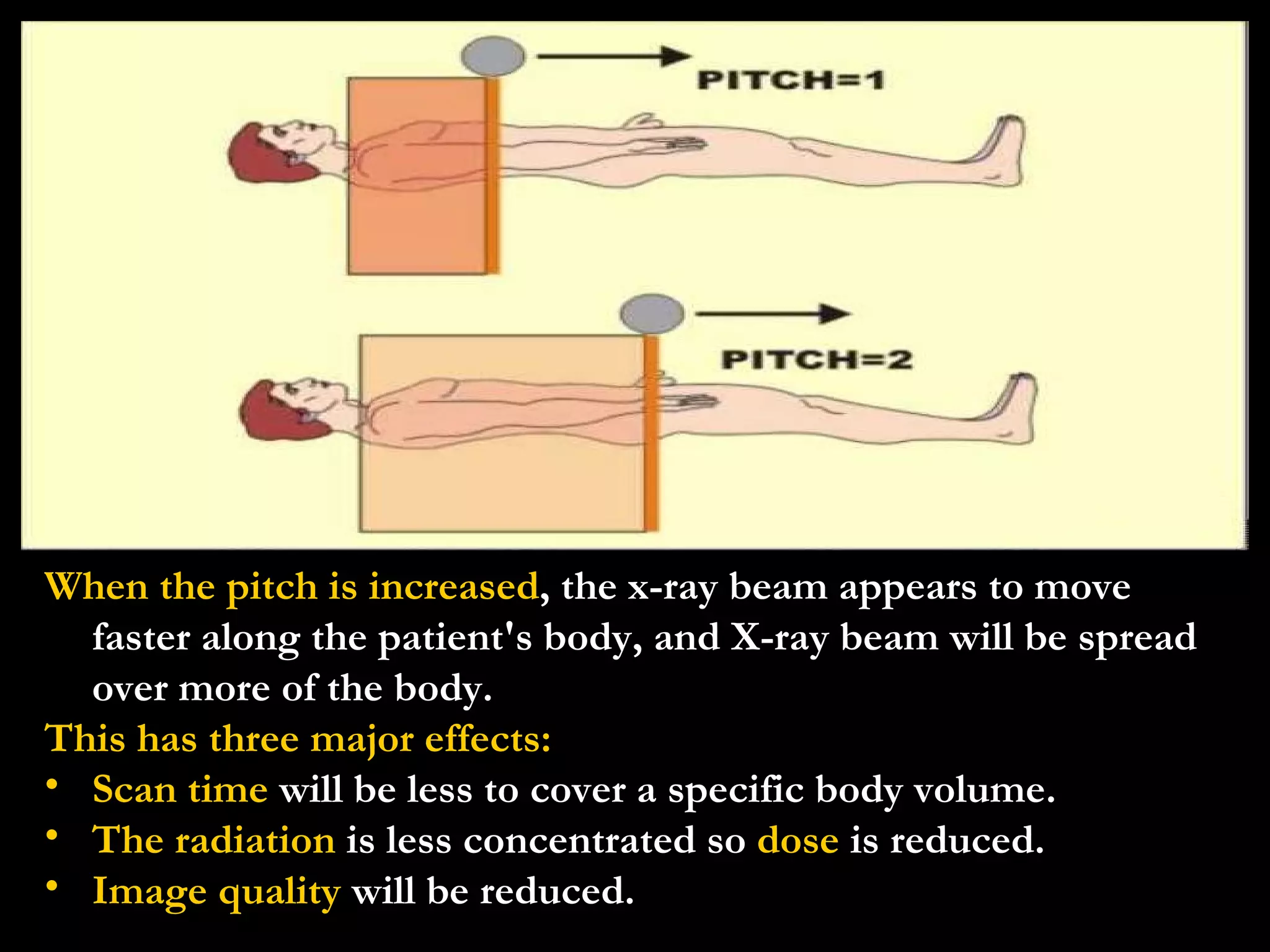 When the pitch is increased , the x-ray beam appears to move faster along the patient's body, and X-ray beam will be spread over more of the body.  This has three major effects: Scan time  will be less to cover a specific body volume.  The radiation  is less concentrated so  dose  is reduced.  Image quality  will be reduced. 