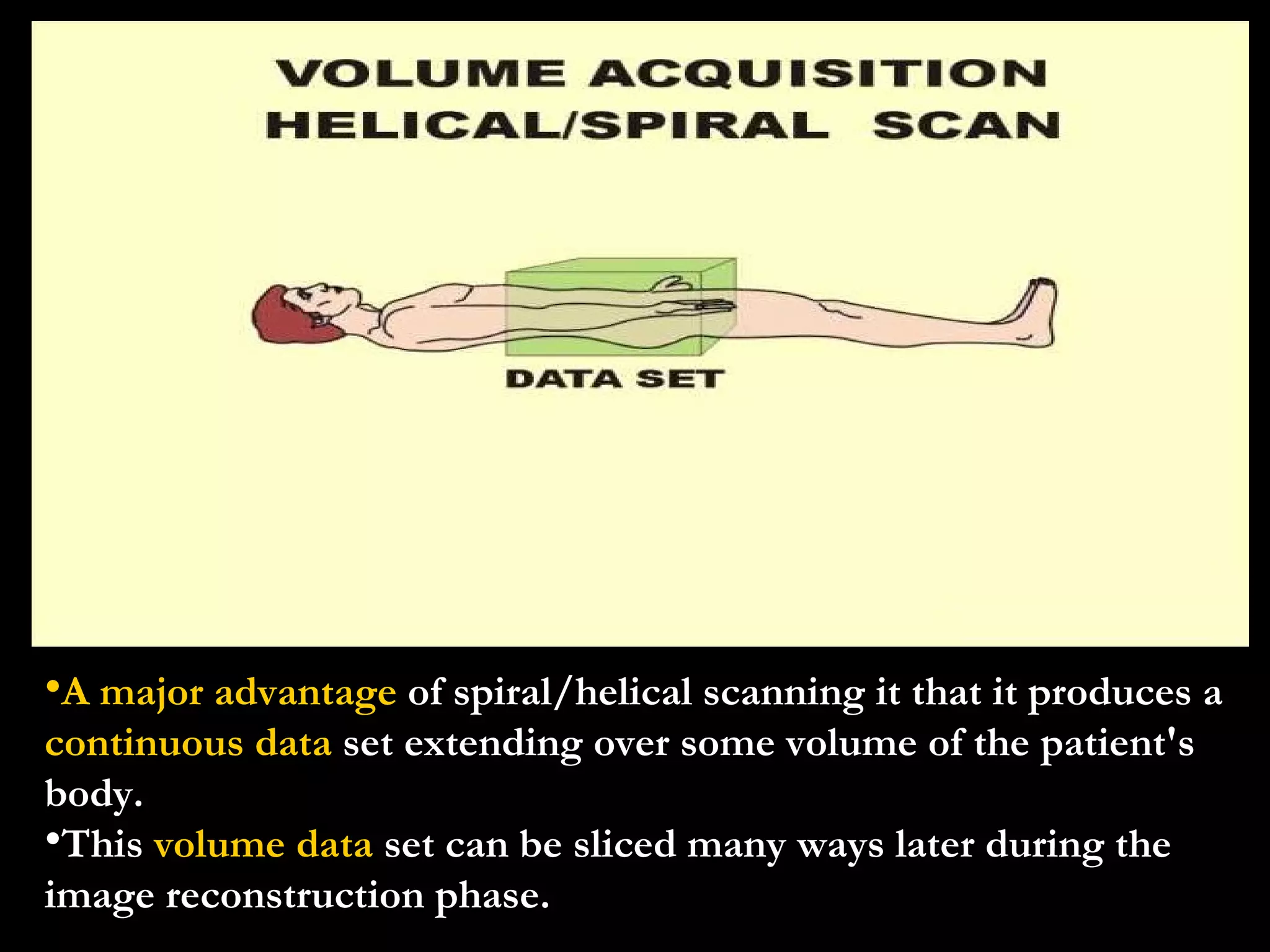 A major advantage  of spiral/helical scanning it that it produces a  continuous data  set extending over some volume of the patient's body. This  volume data  set can be sliced many ways later during the image reconstruction phase. 