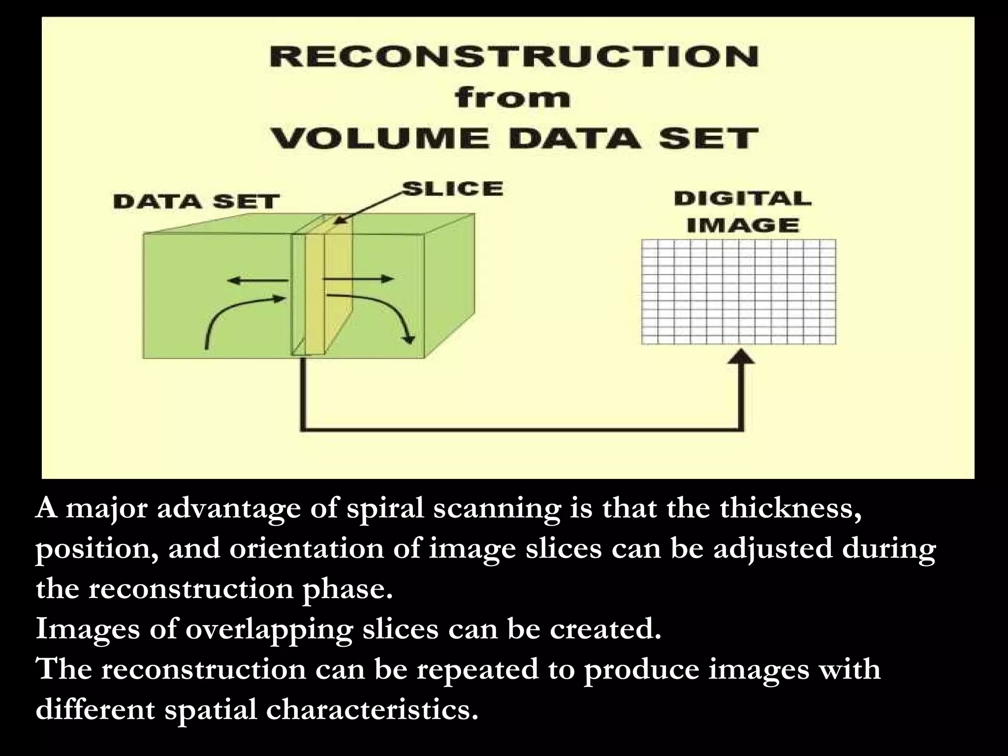 A major advantage of spiral scanning is that the thickness, position, and orientation of image slices can be adjusted during the reconstruction phase. Images of overlapping slices can be created. The reconstruction can be repeated to produce images with different spatial characteristics. 