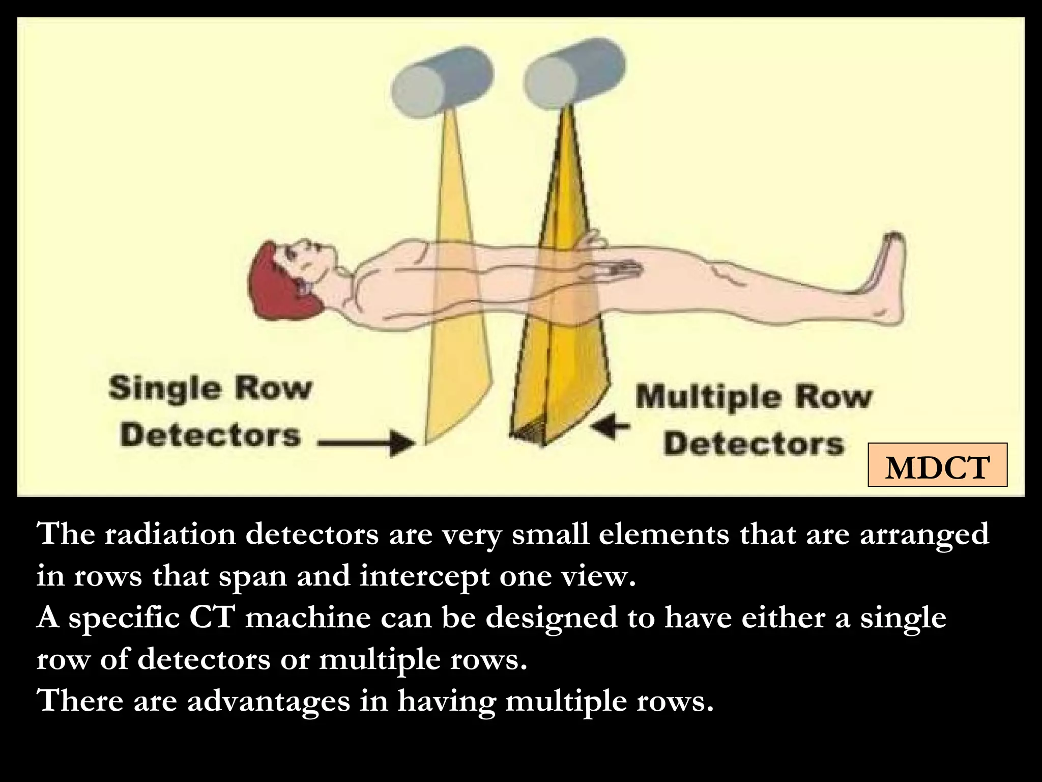 The radiation detectors are very small elements that are arranged in rows that span and intercept one view. A specific CT machine can be designed to have either a single row of detectors or multiple rows. There are advantages in having multiple rows. MDCT 