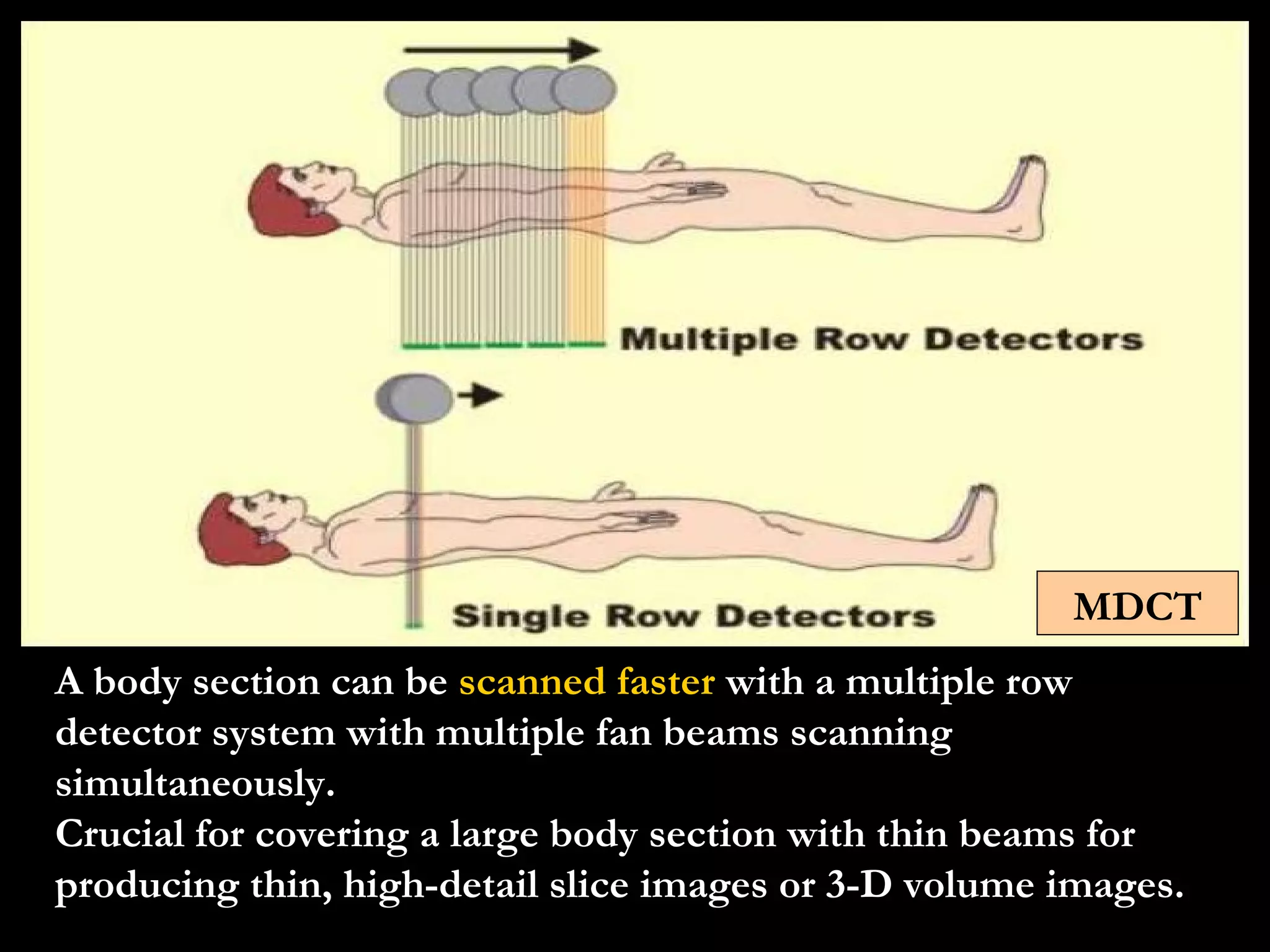A body section can be  scanned faster  with a multiple row detector system with multiple fan beams scanning simultaneously. Crucial for covering a large body section with thin beams for producing thin, high-detail slice images or 3-D volume images. MDCT 