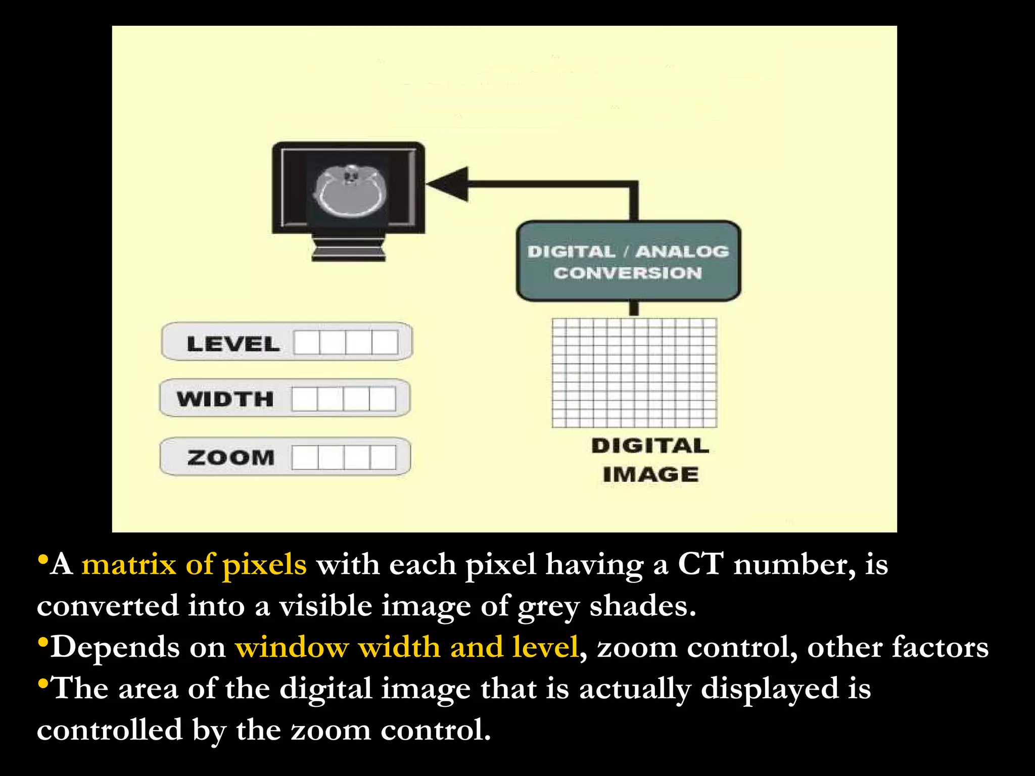 A  matrix of pixels  with each pixel having a CT number, is converted into a visible image of grey shades. Depends on  window width and level , zoom control, other factors The area of the digital image that is actually displayed is controlled by the zoom control. 