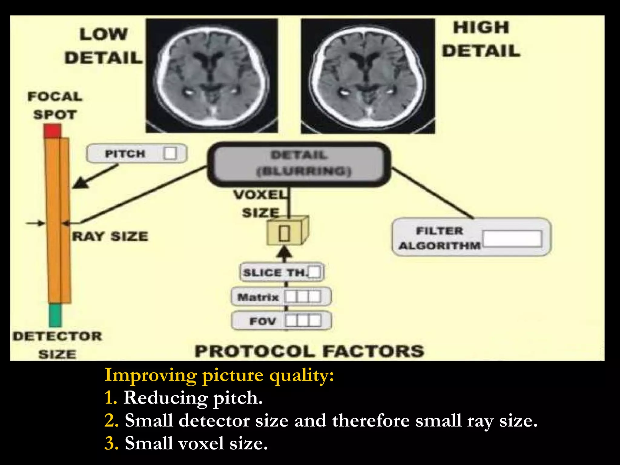 Improving picture quality: 1.  Reducing pitch. 2.  Small detector size and therefore small ray size.  3.  Small voxel size. 
