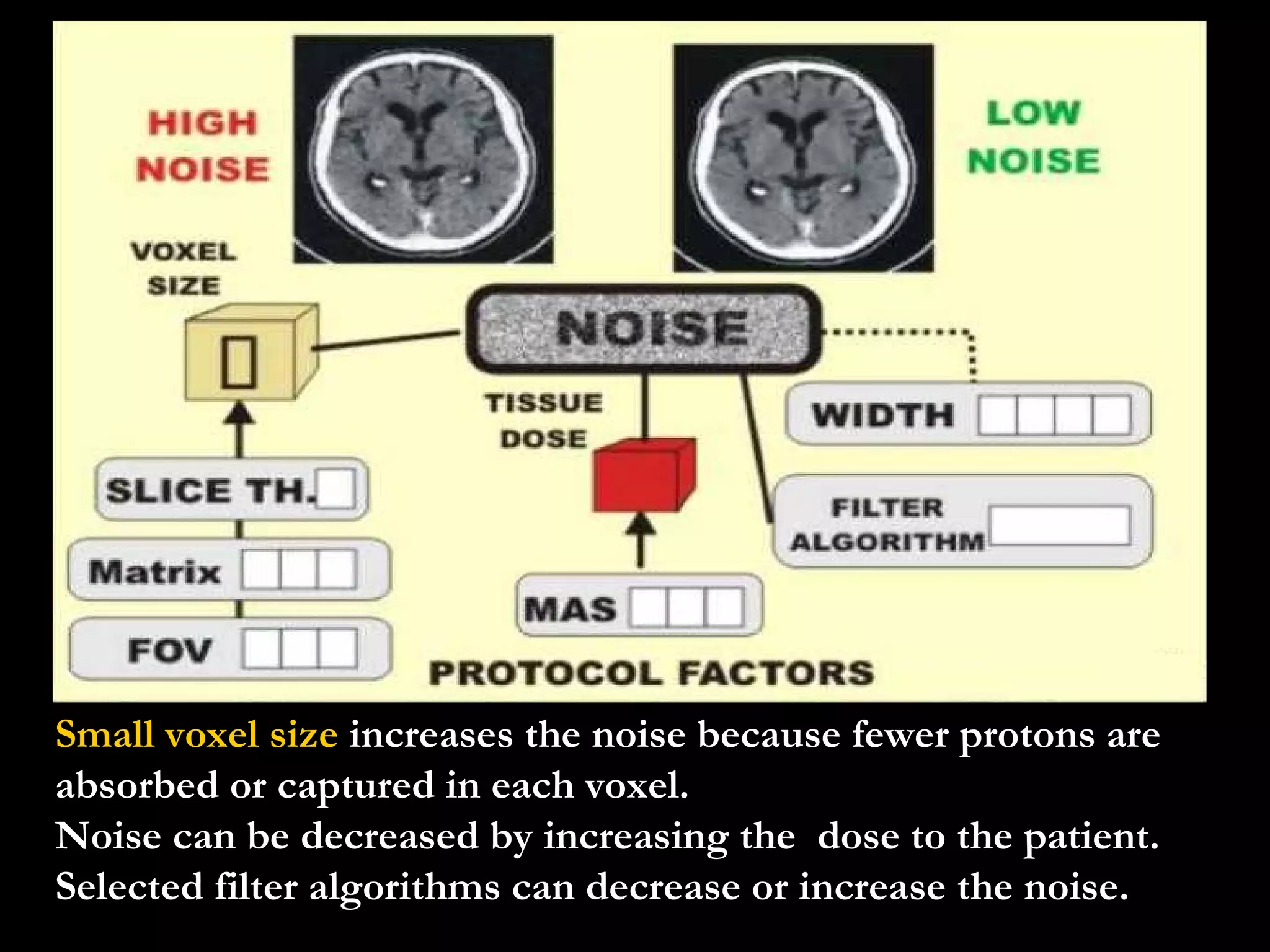 Small voxel size  increases the noise because fewer protons are absorbed or captured in each voxel. Noise can be decreased by increasing the  dose to the patient. Selected filter algorithms can decrease or increase the noise. 