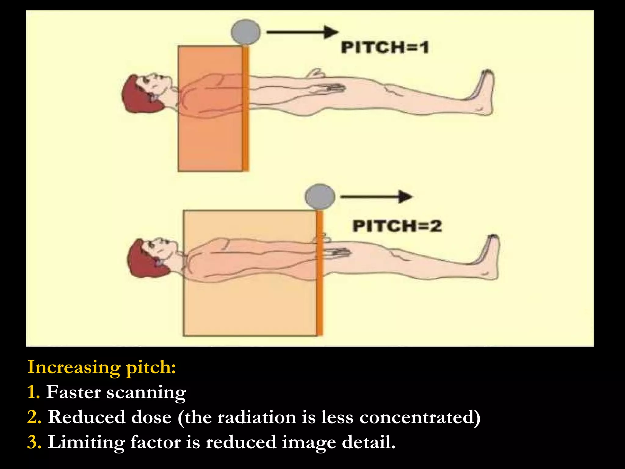Increasing pitch: 1.  Faster scanning 2.  Reduced dose (the radiation is less concentrated) 3.  Limiting factor is reduced image detail. 