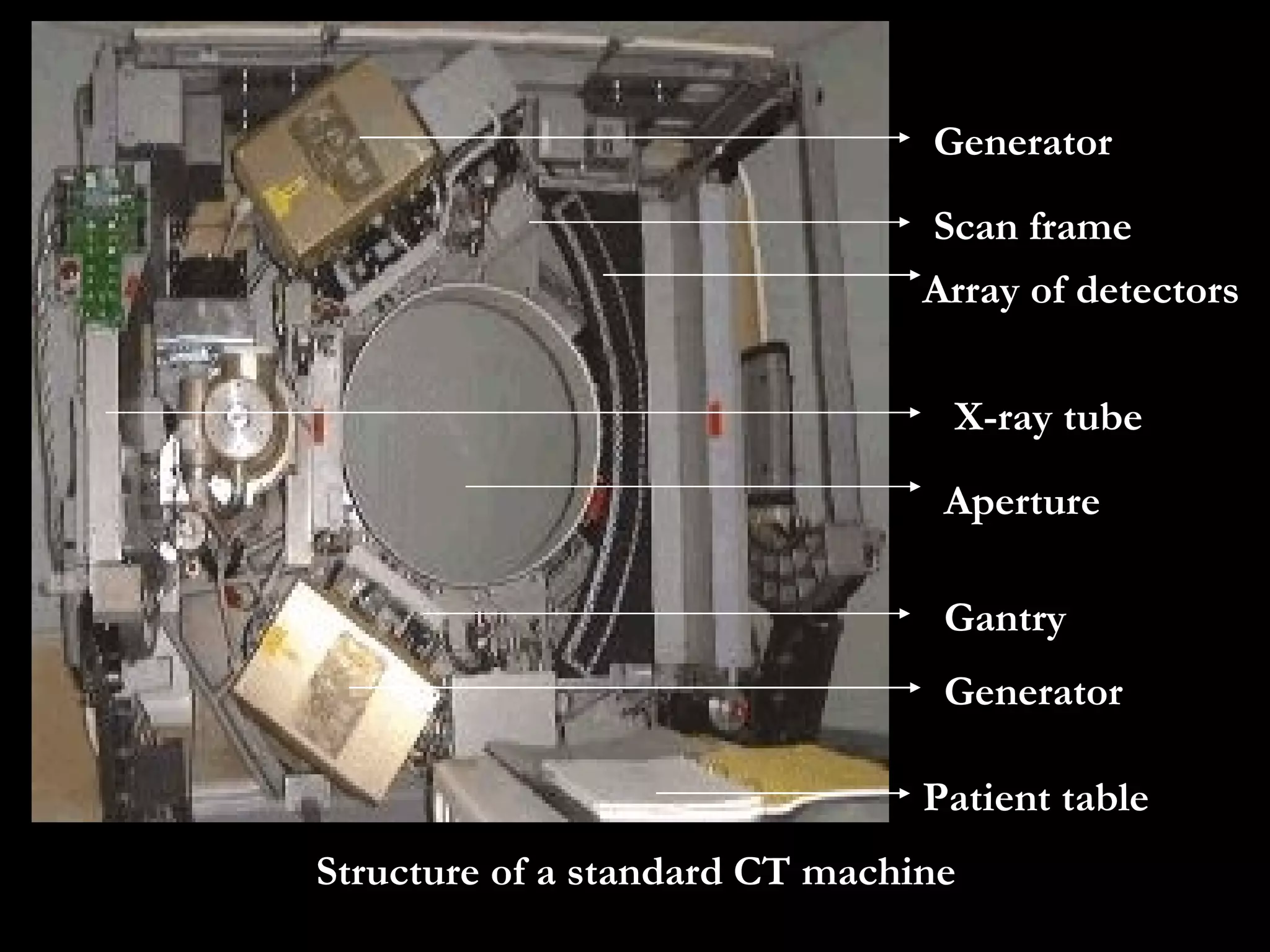 Structure of a standard CT machine   Generator Generator Array of Array of detectors Patient table a Aperture Gantry X-ray tube Scan frame 