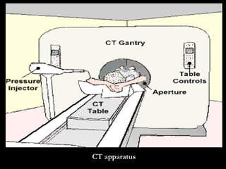 CT apparatus 