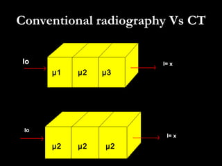 Conventional radiography Vs CT µ1 µ2 µ3 µ2 µ2 µ2 Io I= x I= x Io 