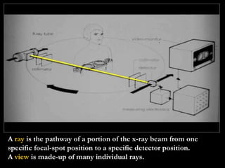 A  ray  is the pathway of a portion of the x-ray beam from one specific focal-spot position to a specific detector position. A  view  is made-up of many individual rays. 