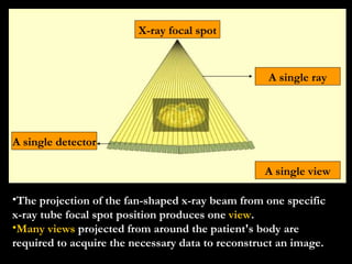 The projection of the fan-shaped x-ray beam from one specific x-ray tube focal spot position produces one  view . Many views  projected from around the patient's body are required to acquire the necessary data to reconstruct an image. A Single view Single ray Single detector X-ray focal spot A single detector A single ray X-ray focal spot A single view 