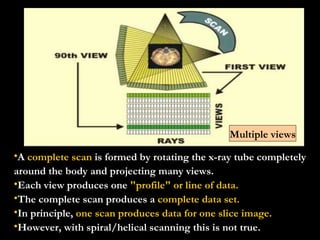 A  complete scan  is formed by rotating the x-ray tube completely around the body and projecting many views.  Each view produces one  "profile" or line of data. The complete scan produces a  complete data set.   In principle,  one scan produces data for one slice image.   However, with spiral/helical scanning this is not true. Multiple views 