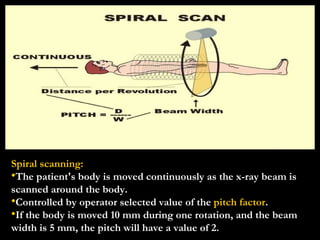 Spiral scanning: The patient's body is moved continuously as the x-ray beam is scanned around the body. Controlled by operator selected value of the  pitch factor . If the body is moved 10 mm during one rotation, and the beam width is 5 mm, the pitch will have a value of 2. 