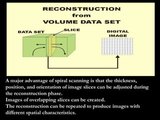 A major advantage of spiral scanning is that the thickness, position, and orientation of image slices can be adjusted during the reconstruction phase. Images of overlapping slices can be created. The reconstruction can be repeated to produce images with different spatial characteristics. 