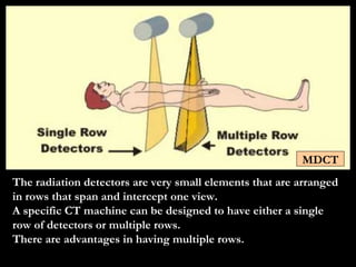 The radiation detectors are very small elements that are arranged in rows that span and intercept one view. A specific CT machine can be designed to have either a single row of detectors or multiple rows. There are advantages in having multiple rows. MDCT 