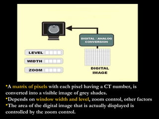 A  matrix of pixels  with each pixel having a CT number, is converted into a visible image of grey shades. Depends on  window width and level , zoom control, other factors The area of the digital image that is actually displayed is controlled by the zoom control. 