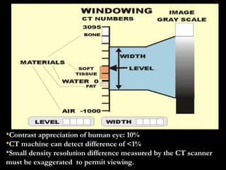 Contrast appreciation of human eye: 10% CT machine can detect difference of <1% Small density resolution difference measured by the CT scanner must be exaggerated  to permit viewing. 