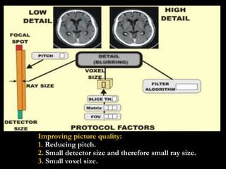 Improving picture quality: 1.  Reducing pitch. 2.  Small detector size and therefore small ray size.  3.  Small voxel size. 