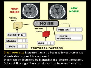 Small voxel size  increases the noise because fewer protons are absorbed or captured in each voxel. Noise can be decreased by increasing the  dose to the patient. Selected filter algorithms can decrease or increase the noise. 