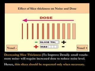 Decreasing Slice Thickness  (To Improve Detail)- small voxels- more noise- will require increased dose to reduce noise level. Hence,  thin slices should be requested only when necessary. Effect of Slice thickness on Noise and Dose Voxel + Voxel - 