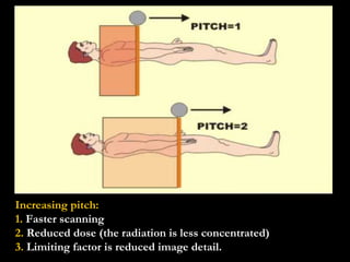Increasing pitch: 1.  Faster scanning 2.  Reduced dose (the radiation is less concentrated) 3.  Limiting factor is reduced image detail. 