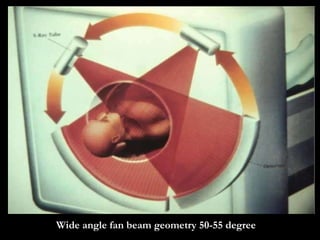 Wide angle fan beam geometry 50-55 degree 