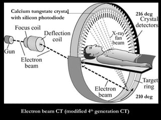 Electron beam CT (modified 4 th  generation CT) Calcium tungstate crystal with silicon photodiode 216 deg 210 deg 