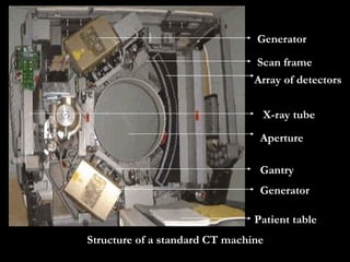 Structure of a standard CT machine   Generator Generator Array of Array of detectors Patient table a Aperture Gantry X-ray tube Scan frame 