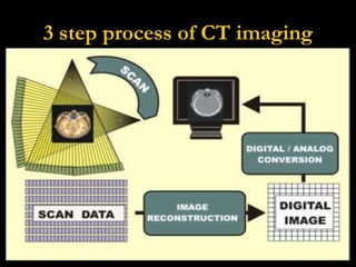 3 step process of CT imaging 