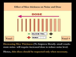 Decreasing Slice Thickness  (To Improve Detail)- small voxels- more noise- will require increased dose to reduce noise lev...