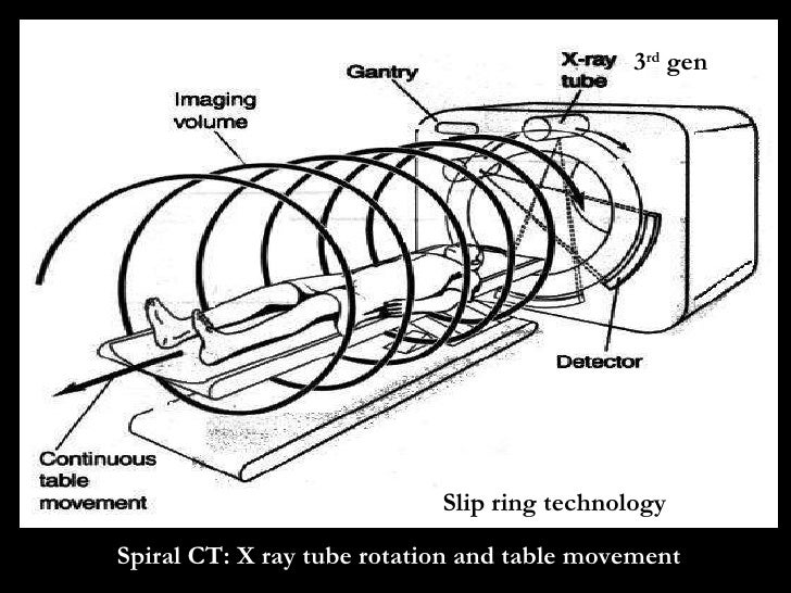 Slip Ring Technology In Ct Scan Slip Ring Technology In Ct Scan