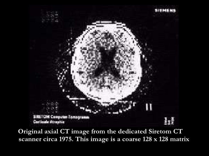 emi and the ct scanner essay The invention and development of the ct scanner is one of the most fascinating tales in the history of radiology it includes of one of the 20th century's most important recording companies, perhaps the most influential recording group of all time, and a nobel laureate in medicine and physiology who never attended medical school or earned a phd. emi and the ct scanner essay The invention and development of the ct scanner is one of the most fascinating tales in the history of radiology it includes of one of the 20th century's most important recording companies, perhaps the most influential recording group of all time, and a nobel laureate in medicine and physiology who never attended medical school or earned a phd.