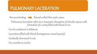 PULMONARY LACERATION
Non penetrating Round walled thin cystic space
Pulmonary laceration refers to a traumatic disruption of alveolar spaces with
formation of a cavity filled with blood or air.
Can be unilateral or bilateral
Laceration filled with blood (homogenous round opacity)
Gradually decreased in size
Few months to resolve
 