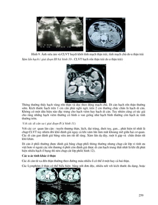 259
H×nh 9. ¶nh siªu ©m vµ CLVT huyÕt khèi tÜnh m¹ch thËn tr¸i, tÜnh m¹ch chñ do u thËn tr¸i
X©m lÊn h¹ch ( giai ®o¹n III b)( h×nh 10-. CLVT h¹ch rèn thËn tr¸i do u thËn tr¸i)
Th«ng th−êng thÊy h¹ch vïng rèn thËn vµ däc theo ®éng m¹ch chñ. Di c¨n h¹ch rèn thËn th−êng
sím. KÝch th−íc h¹ch trªn 1 cm cÇn ph¶i nghi ngê, trªn 2 cm th−êng ch¾c ch¾n lµ h¹ch di c¨n.
Kh«ng cã mét dÊu hiÖu nµo ®Æc tr−ng cho h¹ch viªm hay h¹ch di c¨n. Tuy nhiªn còng cã t¸c gi¶
cho r»ng nh÷ng h¹ch viªm th−êng cã h×nh o van gièng nh− h¹ch b×nh th−êng cßn h¹ch ¸c tÝnh
th−êng trßn.
Víi c¸c di c¨n xa ( giai ®o¹n IV)( h×nh 11)
Víi c¸c c¬ quan l©n cËn : tuyÕn th−îng thËn, l¸ch, ®¹i trµng, ®u«i tuþ, gan... ph¸t hiÖn tè nhÊt lµ
chôp CLVT tuy nhiªn ®«i khã ®¸nh gi¸ ngay c¶ khi x©m lÊn lµm mÊt khoang mì gi÷a hai c¬ quan.
C¸c di c¨n gan ®¸nh gi¸ b»ng siªu ©m rÊt dÔ rµng. X©m lÊn d¹ dµy, ruét Ýt gÆp vµ chÈn ®o¸n rÊt
khã kh¨n.
Di c¨n ë phæi th−êng ®−îc ®¸nh gi¸ b»ng chôp phæi th«ng th−êng nh−ng chôp c¾t líp vi tÝnh −u
viÖt h¬n v× ngoµi c¸c tæn th−¬ng ë phæi cßn ®¸nh gi¸ ®−îc di c¨n h¹ch trung thÊt nhÊt lµ khi ®· ph¸t
hiÖn nhiÒu h¹ch æ bông th× nªn chôp c¾t líp phæi( h×nh 12).
C¸c u ¸c tÝnh kh¸c ë thËn
C¸c di c¨n tõ xa ®Õn thËn th−êng theo ®−êng m¸u nhiÒu æ cã thÓ ë mét hay c¶ hai thËn.
C¸c Lymph«m ë thËn cã thÓ biÓu hiÖn b»ng nèt ®¬n ®éc, nhiÒu nèt víi kÝch th−íc ®a d¹ng, hoÆc
 