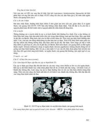 262
Ung th− tæ chøc liªn kÕt
Víi siªu ©m vµ UIV c¸c ung th− tæ chøc liªn kÕt (sarcomes), leiomyosac«m, liposac«m rÊt khã
ph©n biÖt víi ung th− nhu m« vá thËn. CLVT còng chØ cho c¸c dÊu hiÖu gîi ý do tÝnh chÊt ngÊm
thuèc c¶n quang kÐm cña u.
C¸c u di c¨n ë thËn
RÊt khã chÈn ®o¸n, th−êng biÓu hiÖn nhiÒu æ nhá gi¶m ©m trªn siªu ©m, gi¶m ®Ëm vµ Ýt ngÊm
thuèc c¶n quang trªn CLVT. UIV hÇu nh− kh«ng chÈn ®o¸n ®−îc. VÊn ®Ò ®Æt ra lµ cÇn t×m u
nguyªn ph¸t hoÆc ®· biÕt tr−íc mét u nguyªn ph¸t th× chÈn ®o¸n dÔ dµng h¬n.
C¸c u tuyÕn
Th«ng th−êng c¸c u tuyÕn nhÊt lµ c¸c u cã kÝch th−íc nhá th−êng lµ u lµnh. C¸c u nµy kh«ng cã
biÓu hiÖn l©m sµng, hÇu nh− ph¸t triÓn chñ yÕu trong thËn kh«ng v−ît qu¸ bao thËn. Hay gÆp nhÊt
lµ ph× ®¹i cét Bertin. Ph¸t hiÖn chñ yÕu lµ t×nh cê khi th¨m dß. Trªn siªu ©m thÊy khèi th−êng nhá
d−íi 3 cm, cÊu tróc ©m ®ång nhÊt,t−¬ng tù nh− nhu m« vá thËn. Trªn UIV thÊy khèi n»m gi÷a c¸c
®µi hay nhãm ®µi nh−ng kh«ng thÊy dÊu hiÖu chÌn Ðp ®Ì ®Èy ®µi thËn. Trªn chôp c¾t líp vi tÝnh
thÊy khèi cã giíi h¹n râ, chñ yÕu lµ ph× ®¹i cét Bertin. Khi tiªm thuèc c¶n quang khèi cã thÓ ngÊm
thuèc m¹nh (lÐsions tubulaires) hoÆc Ýt ngÊm thuèc (lÐsions papillaires) nh−ng nhanh chãng trë vÒ
gièng m« thËn b×nh th−êng. §èi víi c¸c u nhá d−íi 1,5 cm vÊn ®Ò chÈn ®o¸n ph©n biÖt rÊt khã mµ
nªn theo dâi qu¸ tr×nh t¨ng kÝch th−íc, sù ngÊm thuèc c¶n quang bÊt th−êng, nÕu nghi ngê sÏ can
thiÖp.
U m¹ch - c¬ - mì
C¸c U tÕ bµo lín (oncocytome)
C¸c viªm thËn bÓ thËn cÊp khu tró, ¸p xe thËn(h×nh 15)
C¸c ¸p xe thËn giai ®o¹n ®Çu ®«i khi khã do cÊu tróc vïng viªm nhiÔm to lªn vµ cßn ngÊm thuèc.
Khi ¸p xe ®· h×nh thµnh viÖc chÈn ®o¸n ph©n biÖt dÔ do cã h×nh ¶nh ®Æc tr−ng víi h×nh æ mñ cã
thµnh dÇy kh«ng ®Òu. L©m sµng cña ¸p xe thËn th−êng rÇm ré víi c¸c dÊu hiÖu nhiÔm trïng kh¸
nÆng. Trªn siªu ©m còng cho h×nh ¶nh kh¸ râ víi h×nh æ mñ, thµnh dÇy kh«ng ®Òu. Khi ®Æt ®Çu dß
vµo vïng thËn bÖnh nh©n rÊt ®au.
H×nh 15. CLVT ¸p xe thËn tr−íc vµ sau khi tiªm thuèc c¶n quang tÜnh m¹ch
C¸c nang thËn phøc t¹p (acquired renal cystic disease - ARCD)- xem phÇn ph©n lo¹i nang.
 