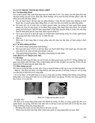 269
Vi. CLVT trong th¨m dß ThËn ghÐp
6.1. Tai biÕn phÉu thuËt
C¸c tô dÞch quanh thËn c¹nh thËn ph¸t hiÖn tèt nhÊt nhê CLVT. Tuy nhiªn cÇn biÕt ph©n biÖt mét
líp dÞch máng sau mæ ë giai ®o¹n ®Çu (b×nh th−êng) víi tô dÞch do th¶i trõ thËn ghÐp ( møc ®é
nhiÒu kÌm biÕn ®æi thËn ghÐp).
• C¸c tói b¹ch huyÕt: rÊt hay gÆp sau ghÐp kho¶ng 3 tuÇn ®«i khi muén h¬n, th−êng cã kÝch
th−íc lín, v« m¹ch, gi¶m ®Ëm, ®ång nhÊt, cã v¸ch, hay khu tró ë d−íi cùc d−íi thËn ghÐp.
• Tói n−íc tiÓu: do rß n−íc tiÓu cã nhiÒu nguyªn nh©n, do miÖng nèi niÖu qu¶n bµng quang
kh«ng tèt, ho¹i tö niÖu qu¶n, rß do kh©u bµng quang. Khi chôp ch−a tiªm thuèc nã cã h×nh
gièng tói b¹ch huyÕt. Sau khi tiªm chôp chËm cã thÓ thÊy nguyªn nh©n rß, hoÆc nÕu cÇn chôp
thËn bÓ thËn ghÐp qua da cung thÊy ®−îc nguyªn nh©n rß.
• C¸c æ ¸p xe ho¸ do tô dÞch l©u ngµy sÏ cã h×nh ¶nh æ dÞch kh«ng trong víi vá dµy ngÊm thuèc
c¶n quang kÌm theo viªm dÇy c¸c tæ chøc l©n cËn.
• M¸u tô
H×nh ¶nh æ dÞch t¨ng ®Ëm tû träng gièng m¸u khi m¸u tan dÇn thÊy cã h×nh gièng æ dÞch
trong...
6.2. C¸c biÕn chøng néi khoa
• C¸c nhiÔm trïng (gièng thËn b×nh th−êng)
• Rèi lo¹n t−íi m¸u: CLVT cã thÓ t×m ®−îc c¸c huyÕt khèi ®éng- tÜnh m¹ch g©y rèi lo¹n t−íi
m¸u nhÊt lµ c¸c m¸u c¾t thêi gian nhanh, xo¾n èc.
• ThËn ghÐp kh«ng ho¹t ®éng : Nªn dïng céng h−ëng tõ chÈn ®o¸n.
VII.Chôp CLVT thËn sau mæ.
7.1. Hè thËn
Th¨m dß t×nh tr¹ng hè thËn sau mæ lµ mét chØ ®Þnh quan träng cña CLVT. Th«ng th−êng c¸c
quai ruét chiÕm chç ë hè thËn. NÕu cã bÊt th−êng nh− tæ chøc t¸i ph¸t cña ung th−, æ dÞch tån d−,
h¹ch th× CLVT ph¸t hiÖn tèt nhÊt( h×nh 28).
7.2. BiÕn chøng sau mæ
C¸c m¸u tô trong hè thËn, tô n−íc tiÓu, æ ¸p xe trong hè thËn cã thÓ x¶y ra sau c¾t thËn b¸n phÇn.
- M¸u tô : dÊu hiÖu tuú thuéc vµo tõng thêi kú nÕu míi sau mæ cã thÓ thÊy æ m¸u tô víi tû trong
cao ®Çn dÇn sÏ dÞch ho¸ cã tû träng thÊp.
- ¸p xe hè thËn: cã thÓ phèi hîp cã c¶ ¸p xe trong nhu m« thËn, th−êng dÞch kh«ng trong kh«ng
®ång nhÊt, cã tû träng dÞch kh¸ cao vá cã thÓ ngÊm thuèc c¶n quang. Tæ chøc mì xung quanh bao
bäc æ dÞch, vá x¬ dÇy lªn.
H×nh 28. U thËn tr¸i t¸i ph¸t sau mæ
- Tô n−íc tiÓu:
Tói dÞch cã tû träng thÊp gièng n−íc tiÓu thµnh tói máng, tæ chøc x¬ xung quanh dÇy lªn vá Ýt
ngÊm thuèc c¶n quang. CÇn l−u ý tói n−íc tiÓu cã thÓ ¸p xe ho¸ t¹o h×nh ¶nh vá tói dÇy lªn, dÞch
trong tói kh«ng trong l¾ng ®äng d¹ng mñ.
- Rß ®éng tÜnh m¹ch sau mæ, thÊy khi cã ®¸i m¸u sau mæ.
- ThiÕu m¸u do nhåi m¸u thÊy h×nh æ nhåi m¸u gi¶m tû träng d¹ng h×nh tam gi¸c ®Ønh
 