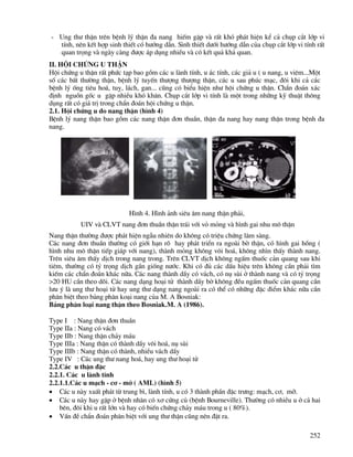 252
- Ung th− thËn trªn bÖnh lý thËn ®a nang hiÕm gÆp vµ rÊt khã ph¸t hiÖn kÓ c¶ chôp c¾t líp vi
tÝnh, nªn kÕt hîp sinh thiÕt cã h−íng dÉn. Sinh thiÕt d−íi h−íng dÉn cña chôp c¾t líp vi tÝnh rÊt
quan träng vµ ngµy cµng ®−îc ¸p dông nhiÒu vµ cã kÕt qu¶ kh¶ quan.
II. HéI CHøNG U THËN
Héi chøng u thËn rÊt phøc t¹p bao gåm c¸c u lµnh tÝnh, u ¸c tÝnh, c¸c gi¶ u ( u nang, u viªm...Mét
sè c¸c bÊt th−êng thËn, bÖnh lý tuyÕn th−îng th−îng thËn, c¸c u sau phóc m¹c, ®«i khi c¶ c¸c
bÖnh lý èng tiªu ho¸, tuþ, l¸ch, gan... còng cã biÓu hiÖn nh− héi chøng u thËn. ChÈn ®o¸n x¸c
®Þnh nguån gèc u gÆp nhiÒu khã kh¨n. Chôp c¾t líp vi tÝnh lµ mét trong nh÷ng kü thuËt th«ng
dông rÊt cã gi¸ trÞ trong chÈn ®o¸n héi chøng u thËn.
2.1. Héi chøng u do nang thËn (h×nh 4)
BÖnh lý nang thËn bao gåm c¸c nang thËn ®¬n thuÇn, thËn ®a nang hay nang thËn trong bÖnh ®a
nang.
H×nh 4. H×nh ¶nh siªu ©m nang thËn ph¶i,
UIV vµ CLVT nang ®¬n thuÇn thËn tr¸i víi vá máng vµ h×nh gai nhu m« thËn
Nang thËn th−êng ®−îc ph¸t hiÖn ngÉu nhiªn do kh«ng cã triÖu chøng l©m sµng.
C¸c nang ®¬n thuÇn th−êng cã giíi h¹n râ hay ph¸t triÓn ra ngoµi bê thËn, cã h×nh gai hång (
h×nh nhu m« thËn tiÕp gi¸p víi nang), thµnh máng kh«ng v«i ho¸, kh«ng nh×n thÊy thµnh nang.
Trªn siªu ©m thÊy dÞch trong nang trong. Trªn CLVT dÞch kh«ng ngÊm thuèc c¶n quang sau khi
tiªm, th−êng cã tû träng dÞch gÇn gièng n−íc. Khi cã ®ñ c¸c dÊu hiÖu trªn kh«ng cÇn ph¶i t×m
kiÕm c¸c chÈn ®o¸n kh¸c n÷a. C¸c nang thµnh dÇy cã v¸ch, cã nô sïi ë thµnh nang vµ cã tû träng
>20 HU cÇn theo dâi. C¸c nang d¹ng ho¹i tö thµnh dÇy bê kh«ng ®Òu ngÊm thuèc c¶n quang cÇn
l−u ý lµ ung th− ho¹i tö hay ung th− d¹ng nang ngoµi ra cã thÓ cã nh÷ng ®Æc ®iÓm kh¸c n÷a cÇn
ph©n biÖt theo b¶ng ph©n ko¹i nang cña M. A Bosniak:
B¶ng ph©n lo¹i nang thËn theo Bosniak.M. A (1986).
Type I : Nang thËn ®¬n thuÇn
Type IIa : Nang cã v¸ch
Type IIb : Nang thËn ch¶y m¸u
Type IIIa : Nang thËn cã thµnh dÇy v«i ho¸, nô sïi
Type IIIb : Nang thËn cã thµnh, nhiÒu v¸ch dÇy
Type IV : C¸c ung th− nang ho¸, hay ung th− ho¹i tö
2.2.C¸c u thËn ®Æc
2.2.1. C¸c u lµnh tÝnh
2.2.1.1.C¸c u m¹ch - c¬ - mì ( AML) (h×nh 5)
• C¸c u nµy xuÊt ph¸t tõ trung b×, lµnh tÝnh, u cã 3 thµnh phÇn ®Æc tr−ng: m¹ch, c¬, mì.
• C¸c u nµy hay gÆp ë bÖnh nh©n cã x¬ cøng cñ (bÖnh Bourneville). Th−êng cã nhiÒu u ë c¶ hai
bªn, ®«i khi u rÊt lín vµ hay cã biÕn chøng ch¶y m¸u trong u ( 80%).
• VÊn ®Ò chÈn ®o¸n ph©n biÖt víi ung th− thËn còng nªn ®Æt ra.
 