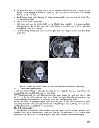 253
• Khi ch−a tiªm thuèc c¶n quang thÊy u lín, cã dÊu hiÖu ®iÓn h×nh lµ chøa tû träng mì ( tû
träng (-) vµ tû träng phÇn mÒm vµo kho¶ng 40 – 90 HU), víi dÊu hiÖu nµy ta cã thÓ kh¼ng
®Þnh lµ u m¹ch - c¬ - mì.
• Sau khi tiªm: thuèc ngÊm ®a d¹ng tuú thuéc vµo thµnh phÇn m¹ch cña u cã thÓ thµnh ®¸m,
vÖt, hay ngo»n nghoÌo.
• Khèi u cã thÓ nhiÒu ë c¶ hai bªn.
• KÝch th−íc khèi u cã thÓ rÊt lín tíi 20 cm vÊn ®Ò chÈn ®o¸n ph©n biÖt víi liposarcome, hoÆc
leiomyosarcome, ®«i khi khã nh−ng c¸c u nµy th−êng lµ sau phóc m¹c vµ ®Ì ®Èy vµo thËn
trong khi c¸c AML lµ u cña thËn.
• C¸c biÕn chøng th−êng thÊy cña AML lµ vì g©y ch¶y m¸u trong u, tô m¸u d−íi bao, hoÆc
quanh thËn.
H×nh 5. ¶nh CLVT u m¹ch c¬ mì thËn ph¶i tr−íc vµ sau khi tiªm thuèc c¶n quang
2.2.1.2 U tÕ bµo lín ( oncocytome )
U lµnh tÝnh, th−êng kh«ng cã dÊu hiÖu l©m sµng ®«i khi cã gÆp ®¸i m¸u, ®au l−ng. U hÇu nh−
kh«ng cã tÝnh x©m lÊn, kh«ng t¸i ph¸t khi phÉu thuËt.
CLVT lµ chØ ®Þnh thÝch hîp, tr−íc khi tiªm thuèc c¶n quang th−êng thÊy h×nh khèi trßn hay bÇu
dôc 3- 5 cm ®«i khi rÊt lín, giíi h¹n râ cã vá bäc.Khèi cã tû träng ®ång nhÊt trõ vßng trung t©m
cã h×nh sao t−¬ng øng víi tæ chøc x¬ sÑo ho¸, c¸c v«i ho¸ cã thÓ gÆp nh−ng hiÕm.
Sau khi tiªm thuèc c¶n quang khèi ngÊm thuèc theo d¹ng h×nh sao ®iÓn h×nh tõ trung t©m ra ngo¹i
biªn, vïng trung t©m lu«n gi¶m ®Ëm h¬n l©n cËn nh−ng kh«ng cã ho¹i tö, kh«ng cã æ ch¶y m¸u.
§«i khi cã h×nh ¶nh khã ph©n biÖt víi ung th− thËn.
2.2.1.3. U cã tiÕt rÐnine
U c¹nh cÇu thËn tiÕt ra rÐnine th−êng thÊy ë ng−êi trÎ cã cao huyÕt ¸p, rÐnine cao trong m¸u,
gi¶m kali huyÕt. ChÈn ®o¸n sinh häc kh«ng ®Æc hiÖu l¾m. Khi lo¹i trõ cao HA do nguyªn nh©n
®éng m¹ch thËn hÑp th× nªn t×m u nµy. Khi phÉu thuËt huyÕt ¸p sÏ trë l¹i b×nh th−ßng ngay.
 