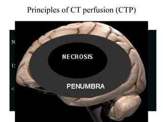 Principles of CT perfusion (CTP)

     CBF
50-80 ml/100 gm/min          normal



15-20     ”               Neurological
                          dysfunction

<10       ”               infarction
 