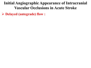 Initial Angiographic Appearance of Intracranial
        Vascular Occlusions in Acute Stroke
 Delayed (antegrade) flow :
 