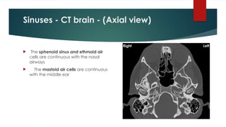 Sinuses - CT brain - (Axial view)
 The sphenoid sinus and ethmoid air
cells are continuous with the nasal
airways
 The mastoid air cells are continuous
with the middle ear
 