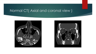 Normal CT( Axial and coronal view )
 