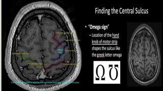 Uncus Radiopaedia Radiological anatomy of brain.pptx